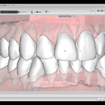 Фото ПО AGE Solutions S.r.l. Maestro 3D Ortho Studio 2